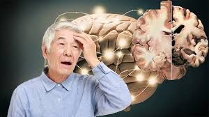 Mất trí nhớ: Nguyên nhân, triệu chứng và cách điều trị